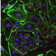 Cardiomyocytes from patients with Duchenne muscular dystrophy corrected by CRISPR-Cpf1. Image: Science Advances
